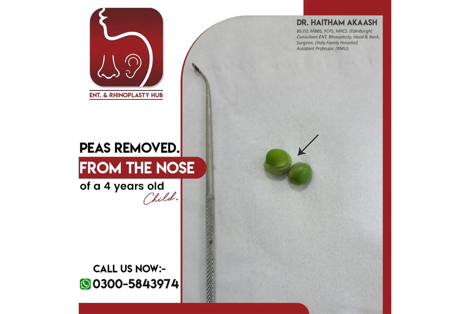 ENT. & RhinoPlasty Hub