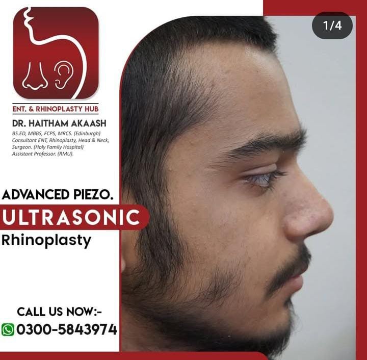 ENT. & RhinoPlasty Hub