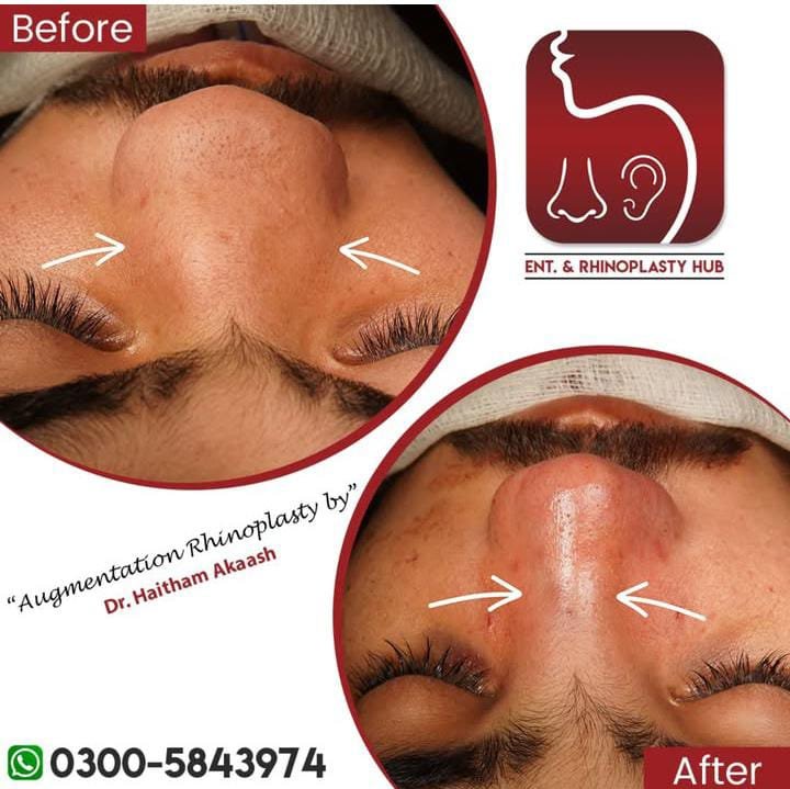 ENT. & RhinoPlasty Hub