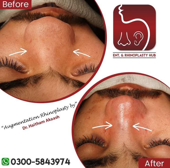 ENT. & RhinoPlasty Hub