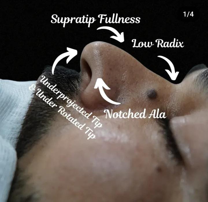 ENT. & RhinoPlasty Hub