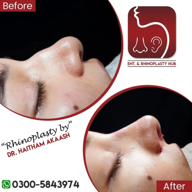 ENT. & RhinoPlasty Hub