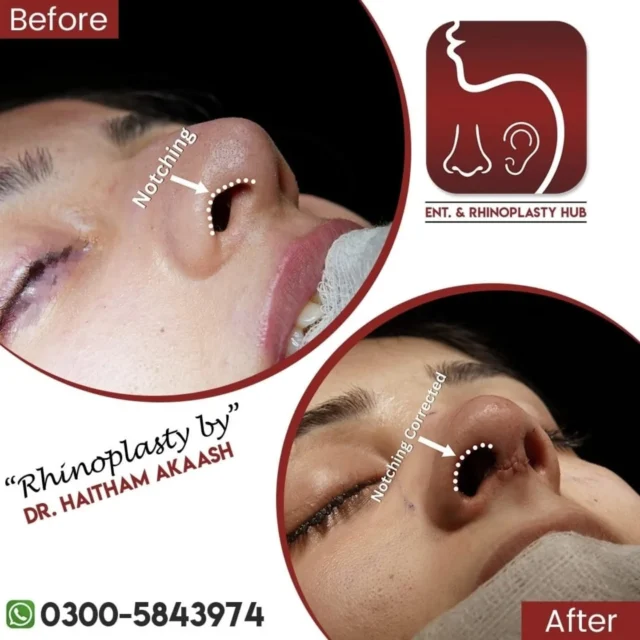 ENT. & RhinoPlasty Hub