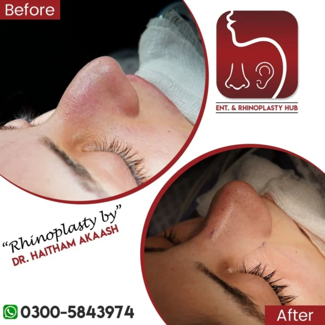 ENT. & RhinoPlasty Hub
