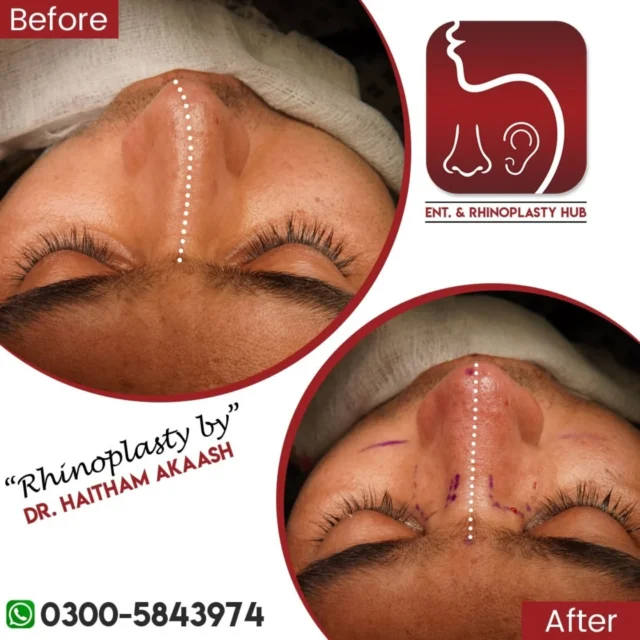 ENT. & RhinoPlasty Hub