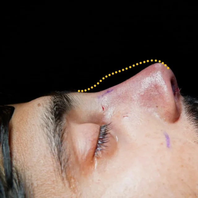 ENT. & RhinoPlasty Hub