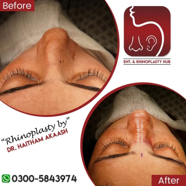 ENT. & RhinoPlasty Hub