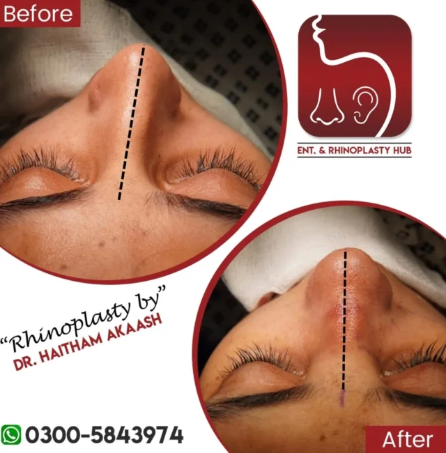 ENT. & RhinoPlasty Hub